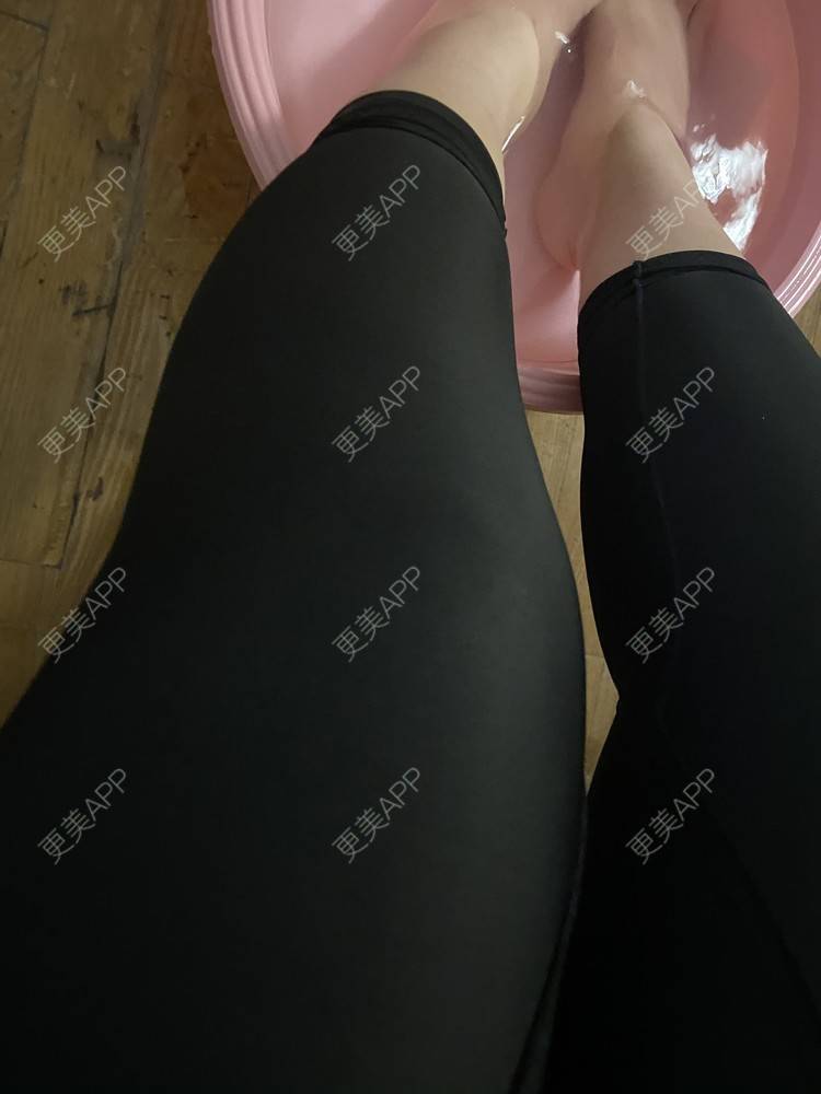 更美 - _ViViLee的吸脂经验 | 吸脂瘦大腿 | 吸脂塑臀 | 超声溶脂瘦大腿 | 射频溶脂瘦大腿 | 光纤溶脂瘦大腿 | 吸脂 | 上海