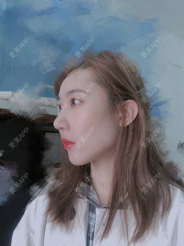 更美 - 会魔法的小仙女肛的鼻部多项经验 | 鼻部多项 | 河源