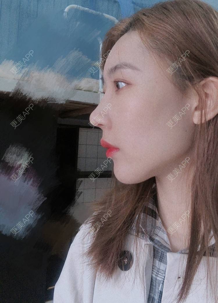 更美 - 会魔法的小仙女肛的鼻部多项经验 | 鼻部多项 | 河源