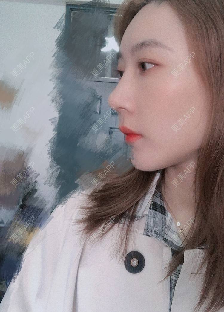 更美 - 会魔法的小仙女肛的鼻部多项经验 | 鼻部多项 | 河源
