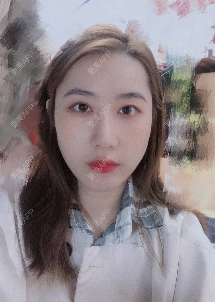 更美 - 会魔法的小仙女肛的鼻部多项经验 | 鼻部多项 | 河源
