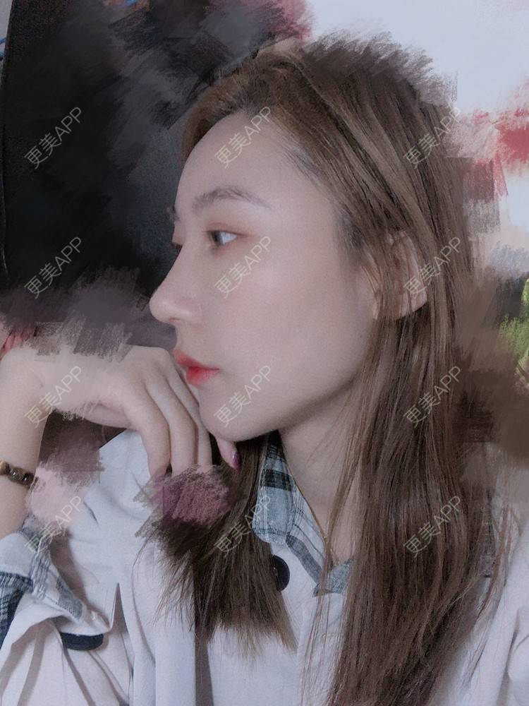 更美 - 会魔法的小仙女肛的鼻部多项经验 | 鼻部多项 | 河源