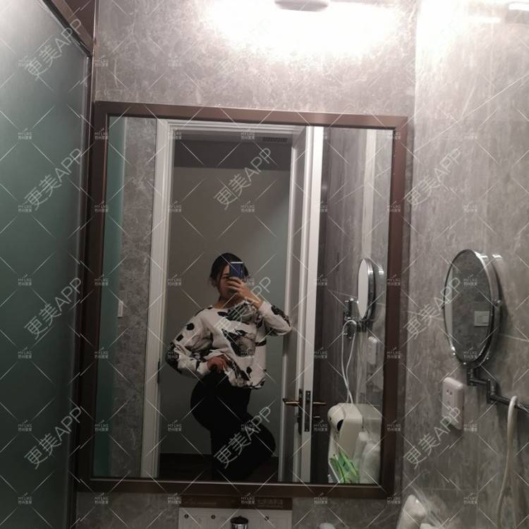 更美 - 更美用户W3Th6XhOzv的耳软骨隆鼻经验 | 耳软骨隆鼻 | 苏州