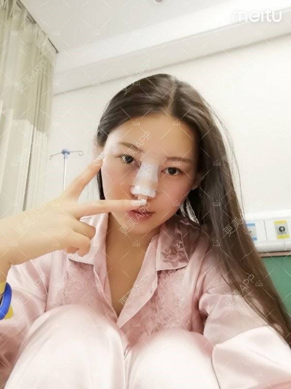 更美 - 更美用户W3Th6XhOzv的耳软骨隆鼻经验 | 耳软骨隆鼻 | 苏州