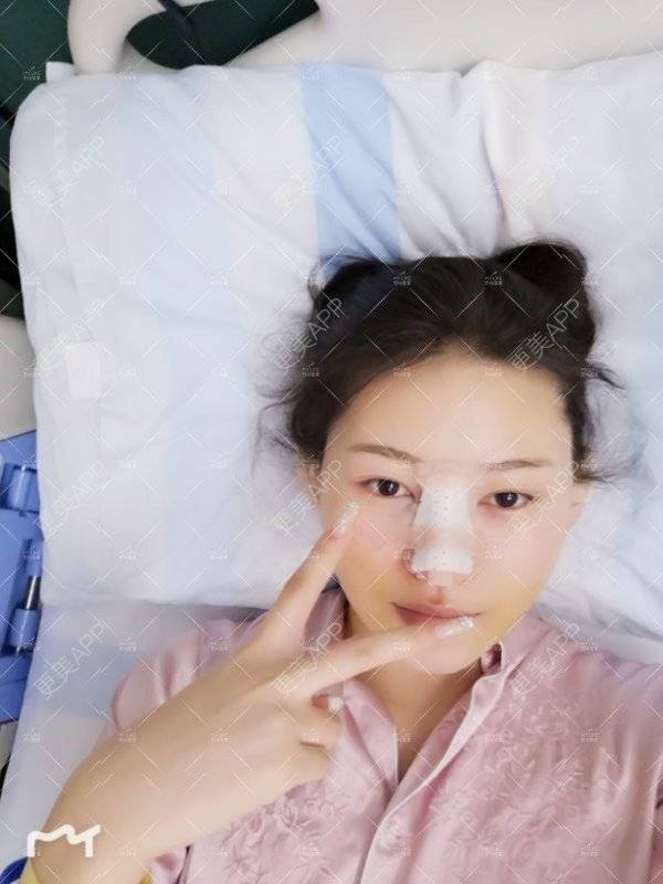 更美 - 更美用户W3Th6XhOzv的耳软骨隆鼻经验 | 耳软骨隆鼻 | 苏州