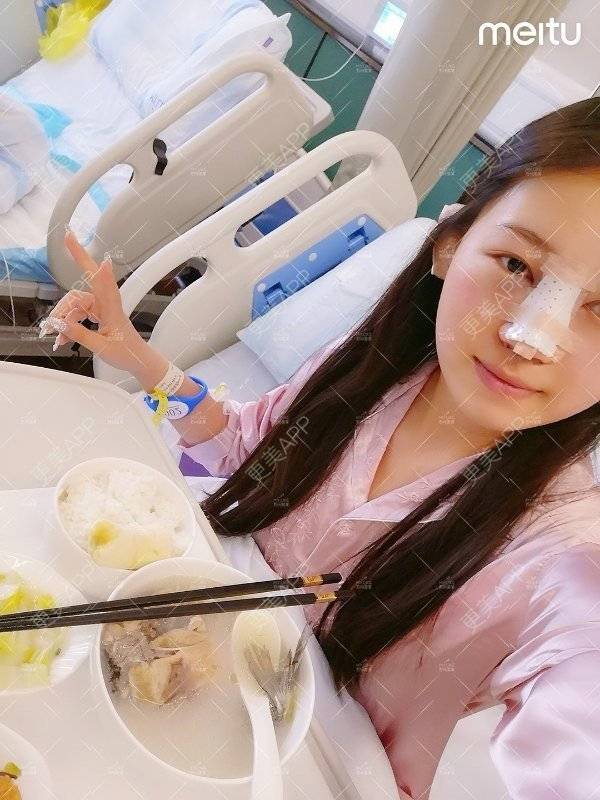 更美 - 更美用户W3Th6XhOzv的耳软骨隆鼻经验 | 耳软骨隆鼻 | 苏州