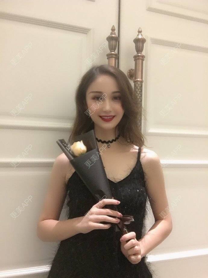 更美 - 更美用户iMDKsqhfhg的埋线提升经验 | 埋线提升 | 埋线除皱 | 除皱套餐 | 祛皱 | 抗衰紧致 | 武汉