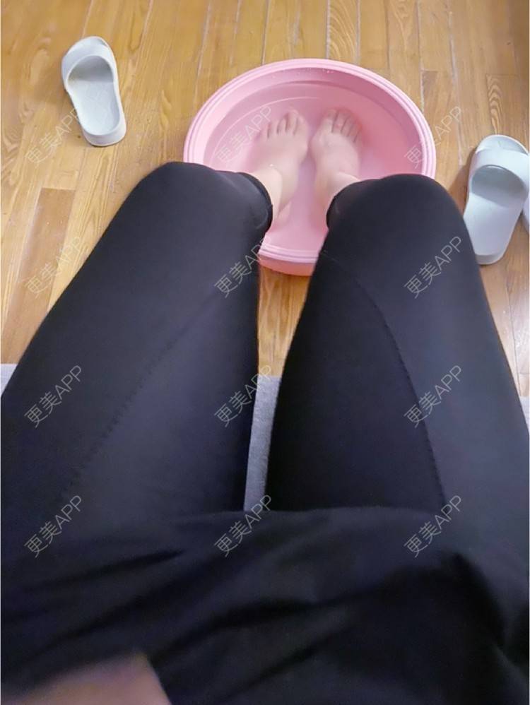 更美 - _ViViLee的吸脂经验 | 吸脂瘦大腿 | 吸脂塑臀 | 超声溶脂瘦大腿 | 吸脂 | 上海 | 射频溶脂瘦大腿 | 光纤溶脂瘦大腿