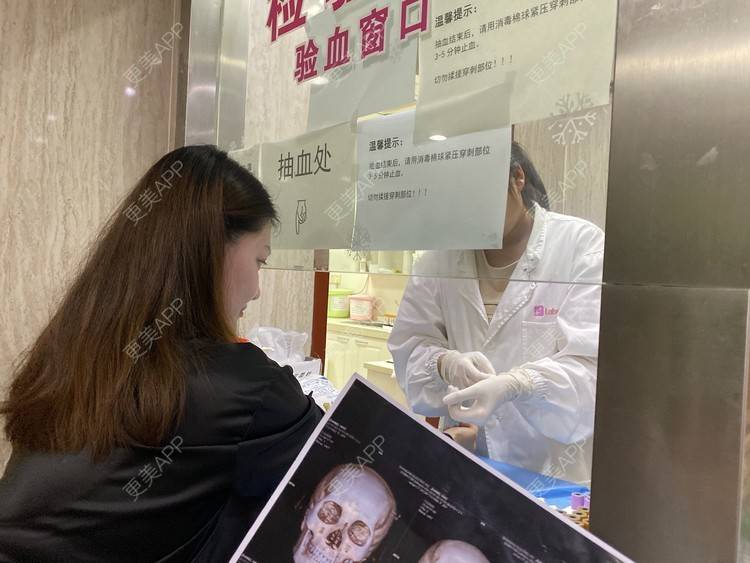 更美 - 想磨骨的飘飘的颧骨颧弓经验 | 颧骨颧弓整形 | 颧骨内推 | 颧骨颧弓 | 下颌角切除 | 取颊脂垫瘦脸 | 上海 | V脸套餐