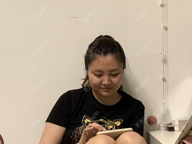 更美 - 想磨骨的飘飘的颧骨颧弓经验 | 颧骨颧弓整形 | 颧骨内推 | 颧骨颧弓 | 下颌角切除 | 取颊脂垫瘦脸 | 上海 | V脸套餐
