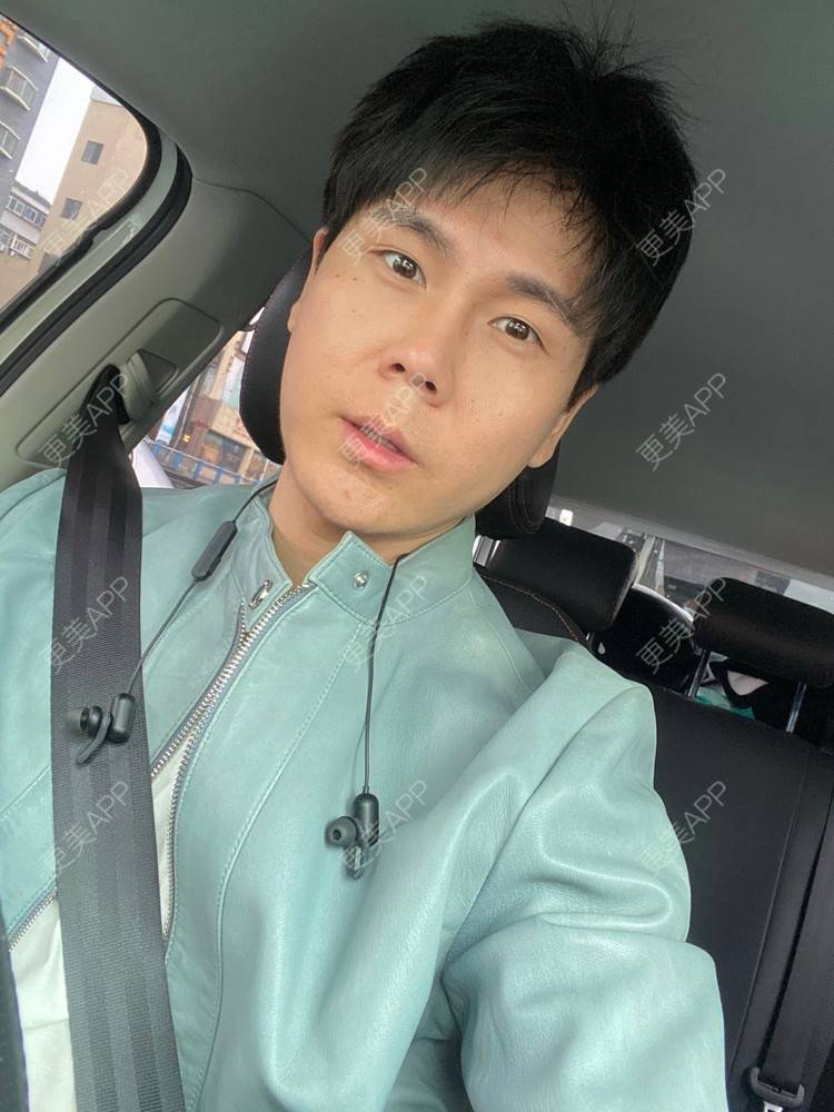 更美 - 冯仕琪的耳软骨隆鼻经验 | 济南 | 耳软骨隆鼻