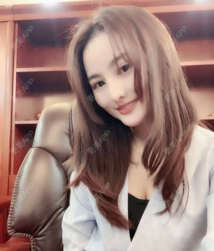 更美 - 更美用户tYzlahBO6T的植发际线经验 | 植发际线 | 深圳 | 毛发移植