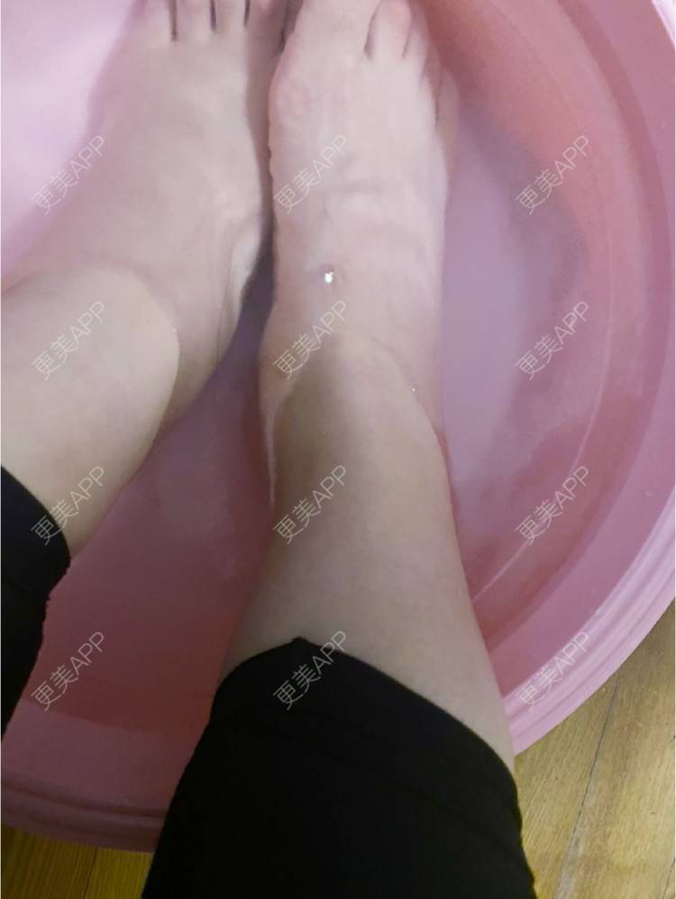 更美 - _ViViLee的吸脂经验 | 吸脂瘦大腿 | 吸脂塑臀 | 吸脂 | 上海 | 射频溶脂瘦大腿 | 超声溶脂瘦大腿 | 光纤溶脂瘦大腿