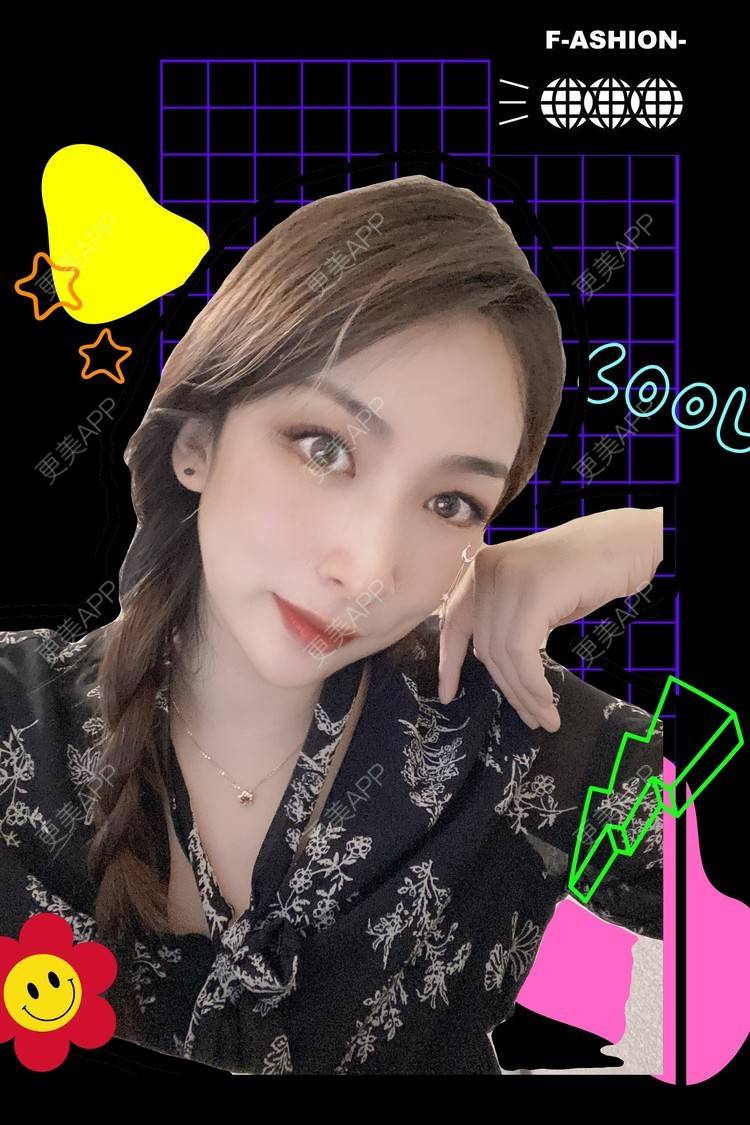 更美 - _ViViLee的自体脂肪丰太阳穴经验 | 自体脂肪丰太阳穴 | 自体脂肪丰额头 | 上海 | 自体脂肪垫眉弓