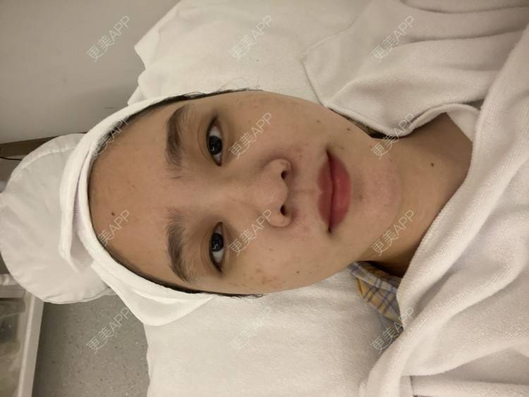 更美 - 更美用户Z50yfz3F6O的激光洗眉经验 | 广州 | 激光洗眉