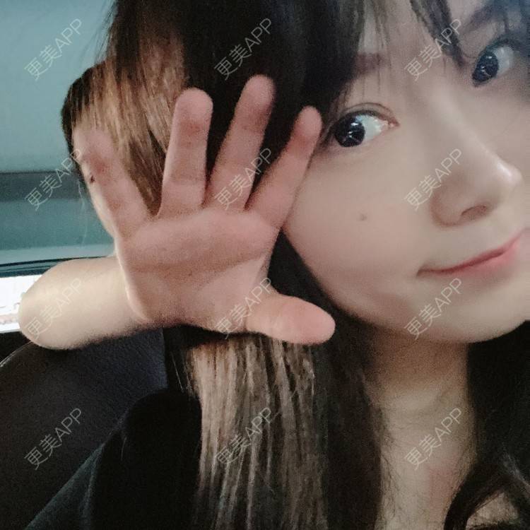 更美 - 更美用户TWh6Lwlq30的拔龋齿经验 | 拔龋齿