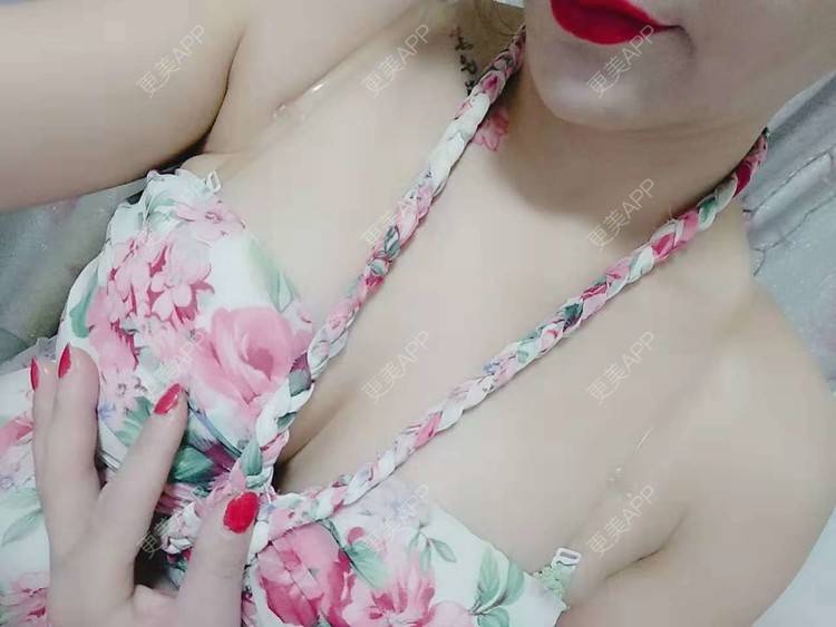 更美 - 更美用户CQ7WrXWLlK的乳房再造经验 | 乳房再造 | 假体隆胸 | 美胸套餐 | 重庆