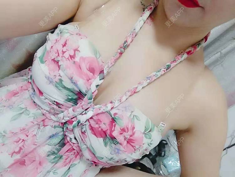 更美 - 更美用户CQ7WrXWLlK的乳房再造经验 | 乳房再造 | 假体隆胸 | 美胸套餐 | 重庆