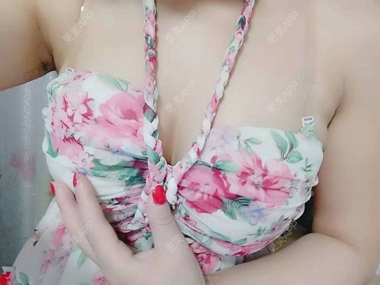 更美 - 更美用户CQ7WrXWLlK的乳房再造经验 | 乳房再造 | 假体隆胸 | 美胸套餐 | 重庆