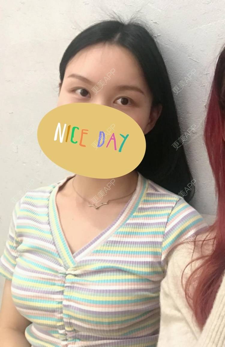 更美 - 更美用户1fHxMDJVIE的眼部多项经验 | 眼部多项 | 广州