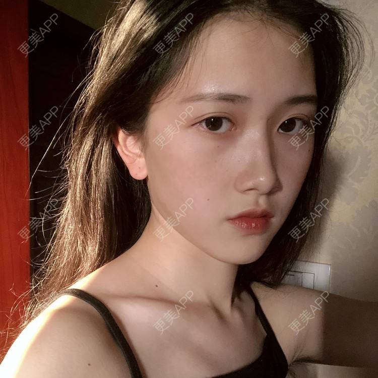 更美 - 更美用户ezaery6fSs的眼部多项经验 | 眼部多项 | 广州 | 视频日记