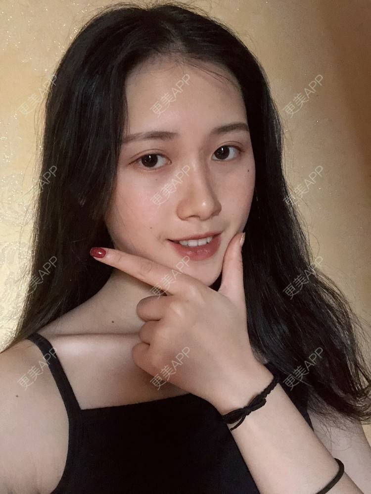 更美 - 更美用户ezaery6fSs的眼部多项经验 | 眼部多项 | 广州 | 视频日记