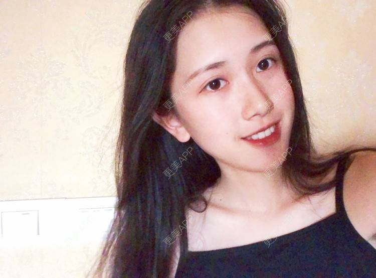 更美 - 更美用户ezaery6fSs的眼部多项经验 | 眼部多项 | 广州 | 视频日记