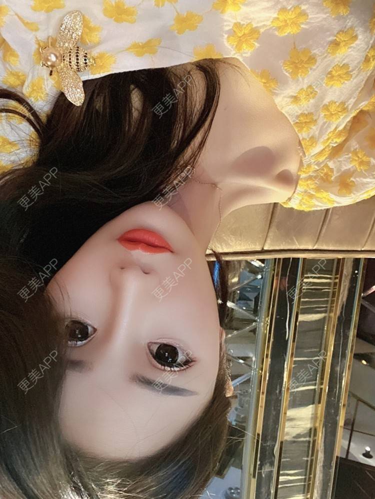 更美 - 酢乙女爱+花轮的除皱瘦脸经验 | 除皱瘦脸 | 玻尿酸全面部 | 南京