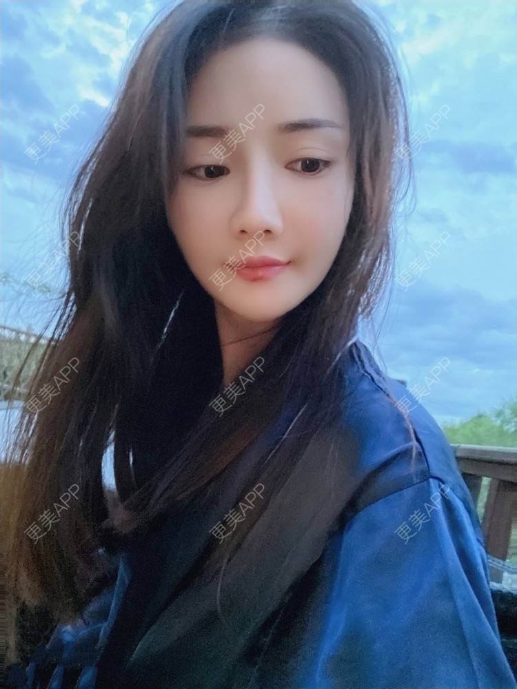 更美 - 酢乙女爱+花轮的除皱瘦脸经验 | 除皱瘦脸 | 玻尿酸全面部 | 南京