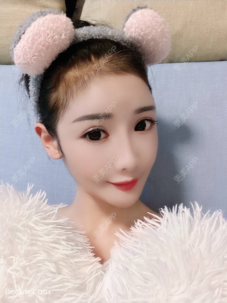 更美 - 酢乙女爱+花轮的除皱瘦脸经验 | 除皱瘦脸 | 南京