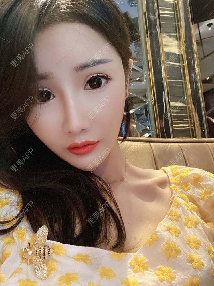 更美 - 酢乙女爱+花轮的除皱瘦脸经验 | 除皱瘦脸 | 南京