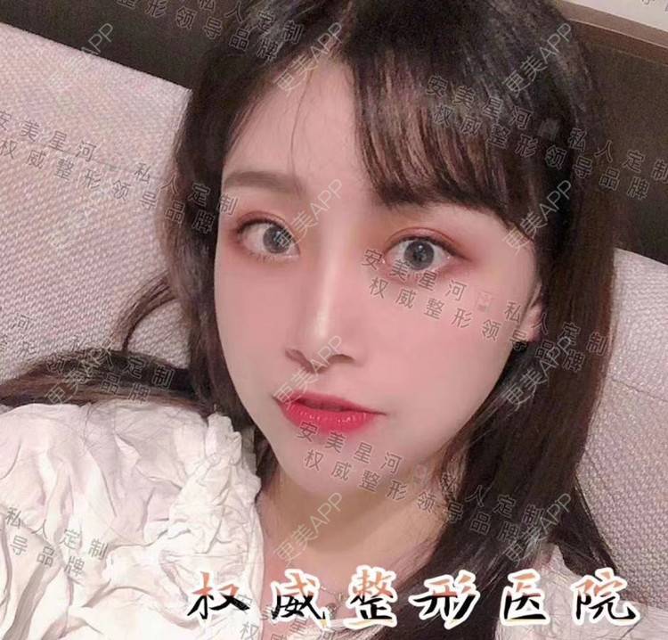 更美 - 郑州安美星河的双眼皮经验 | 双眼皮 | 注射美白 | 水光项目 | 隆鼻 | 郑州