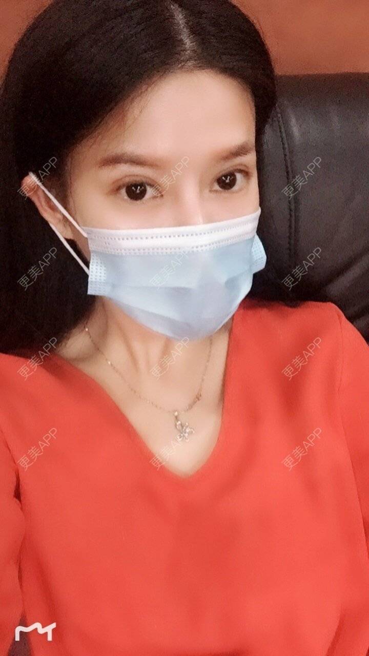 更美 - 甘思佳的热玛吉经验 | 北京 | 热玛吉