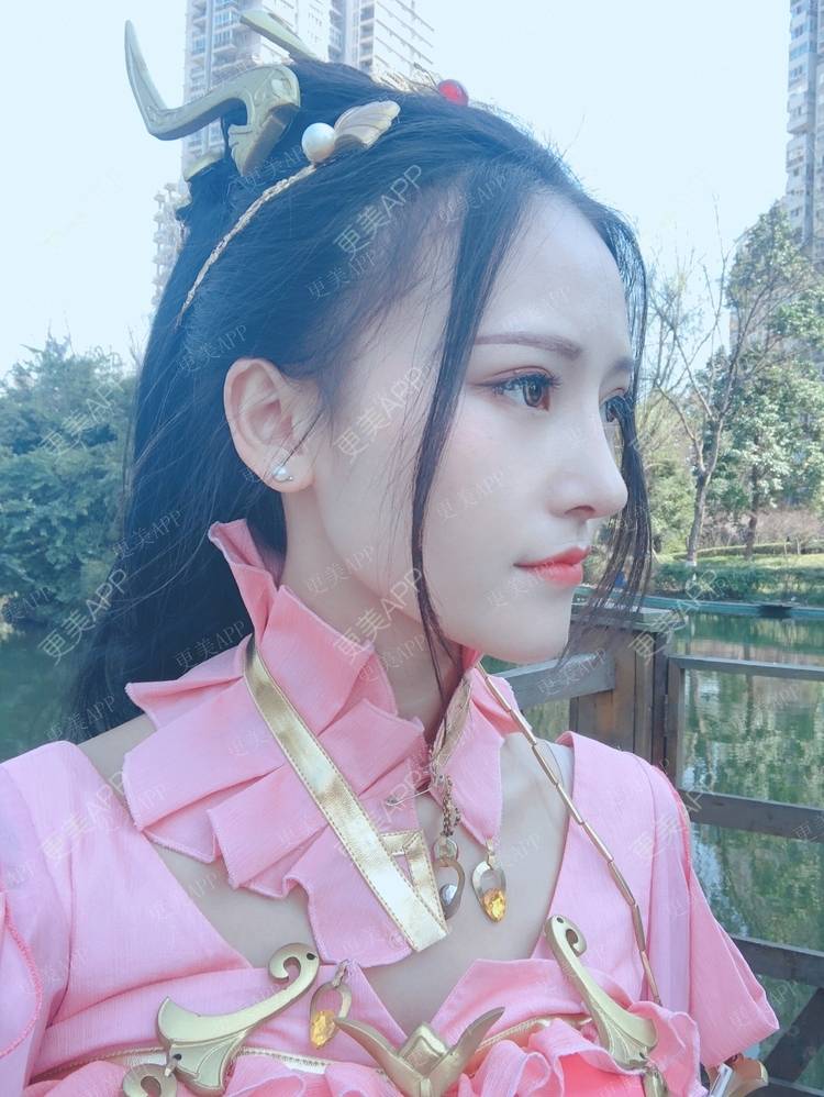 更美 - 行▍24°温暧。.的下颌角整形经验 | 颧骨内推 | 颧骨提高 | 轮廓修复术 | 颧弓降低 | 下颌角切除 | 颧骨颧弓整形 | 下颌角整形 | 视频日记 | 成都