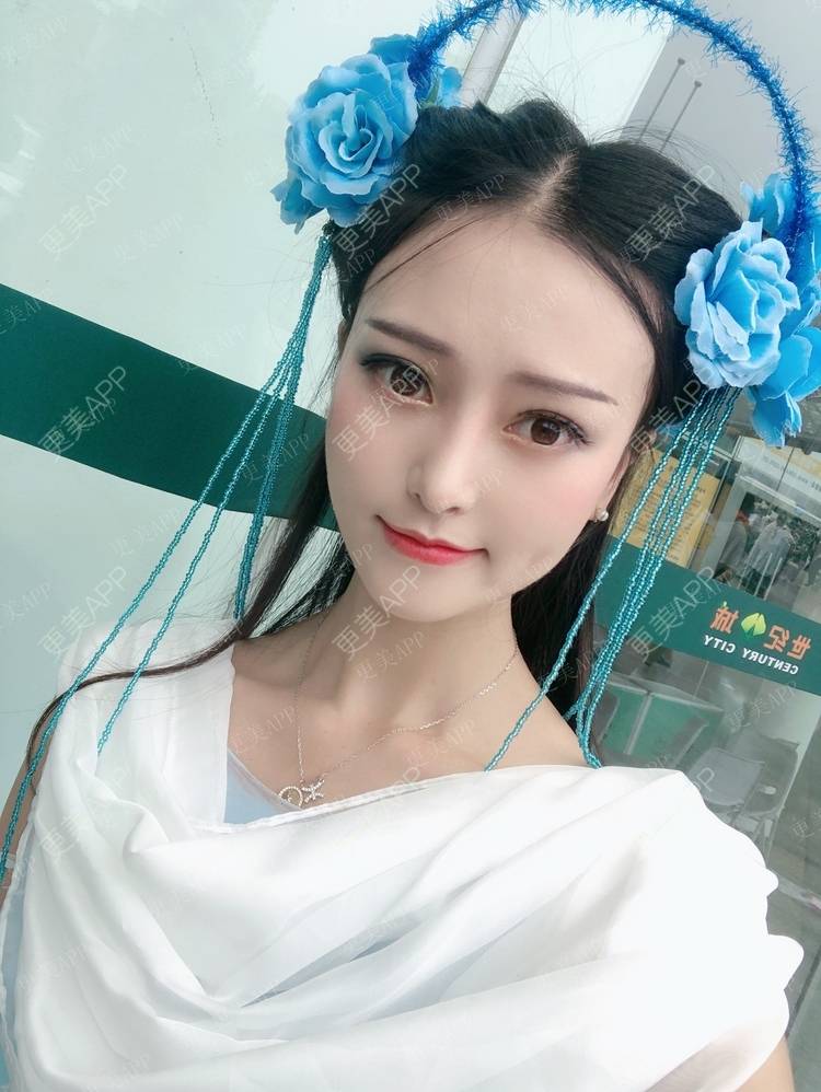更美 - 行▍24°温暧。.的下颌角整形经验 | 颧骨内推 | 颧骨提高 | 轮廓修复术 | 颧弓降低 | 下颌角切除 | 颧骨颧弓整形 | 下颌角整形 | 视频日记 | 成都