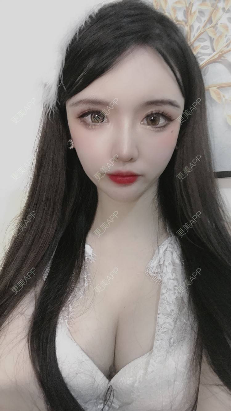 更美 - 晴天baby的假体隆胸经验 | 假体隆胸 | 郑州