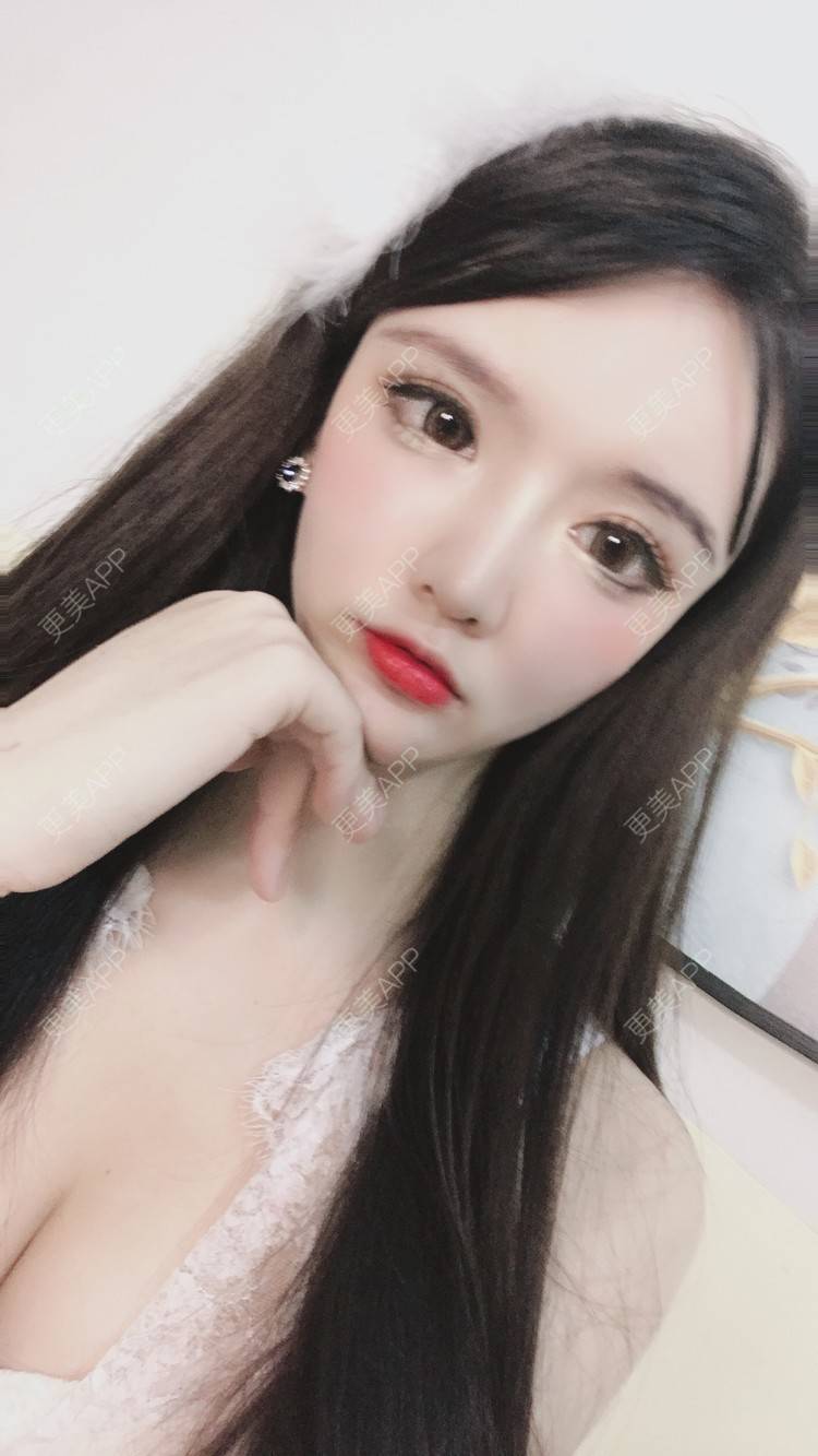 更美 - 晴天baby的假体隆胸经验 | 假体隆胸 | 郑州