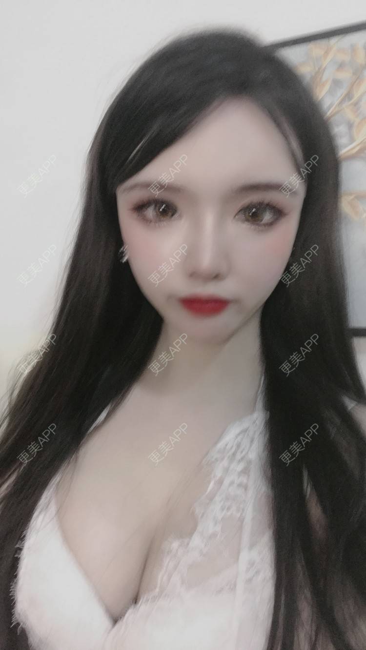 更美 - 晴天baby的假体隆胸经验 | 假体隆胸 | 郑州