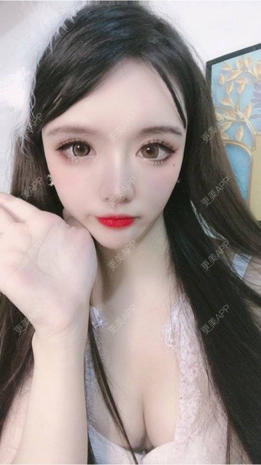 更美 - 晴天baby的假体隆胸经验 | 假体隆胸 | 郑州