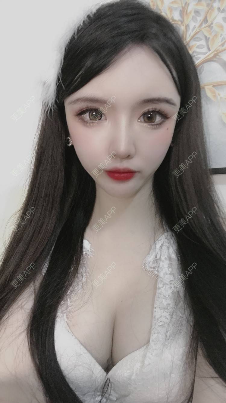 更美 - 晴天baby的假体隆胸经验 | 假体隆胸 | 郑州