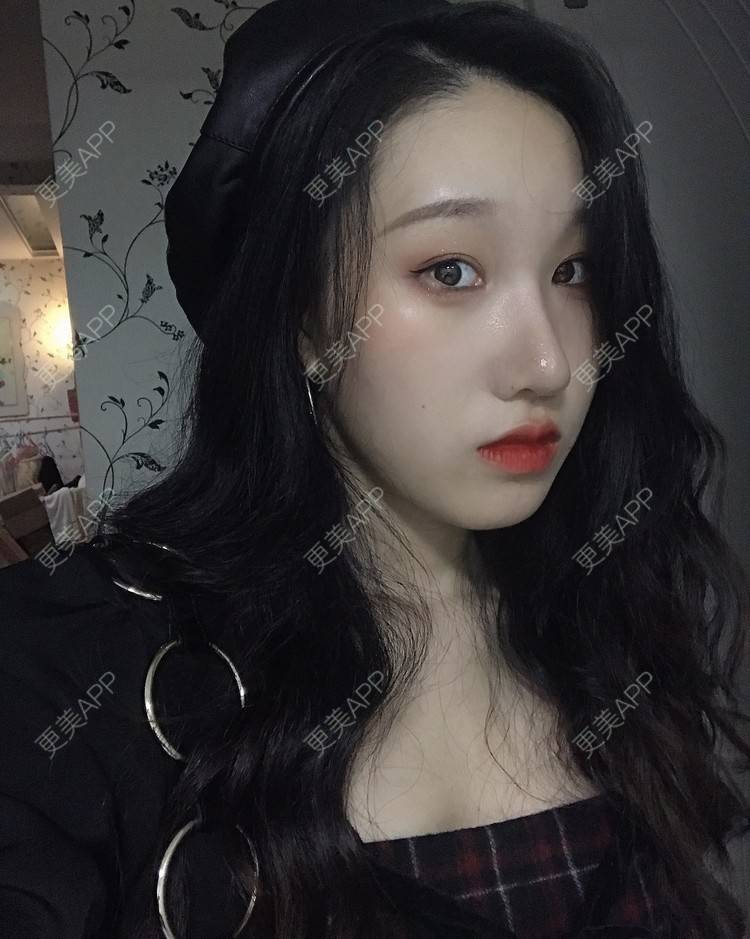 更美 - 荏苒时光岁月如梭的鼻部多项经验 | 鼻部多项 | 肋软骨隆鼻 | 重庆 | 鼻小柱延长
