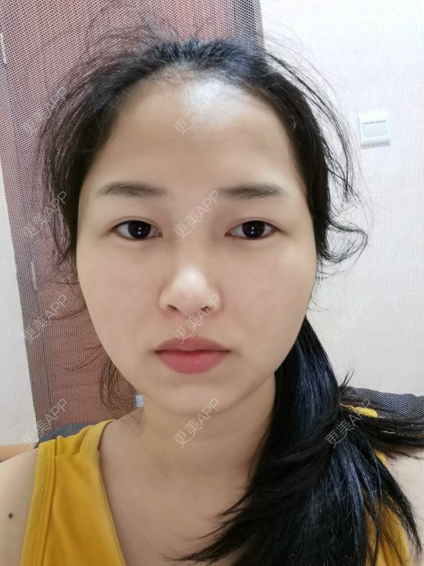 更美 - 小桃桃源的清洁水光补水经验 | 广州 | 清洁水光补水