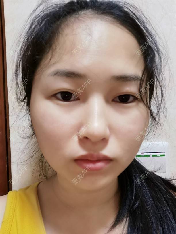 更美 - 小桃桃源的清洁水光补水经验 | 广州 | 清洁水光补水