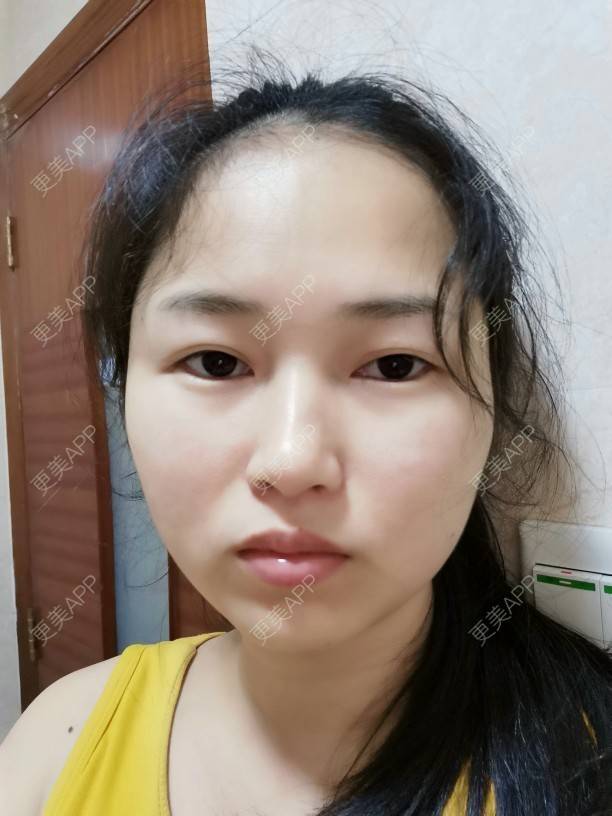 更美 - 小桃桃源的清洁水光补水经验 | 广州 | 清洁水光补水