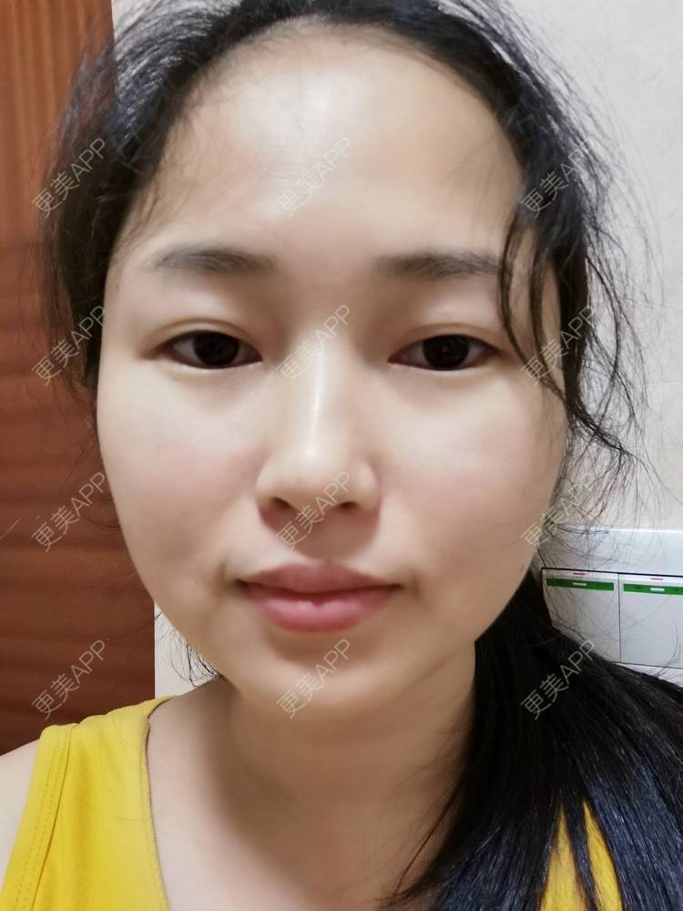 更美 - 小桃桃源的清洁水光补水经验 | 皮肤综合管理套餐 | 广州 | 清洁水光补水