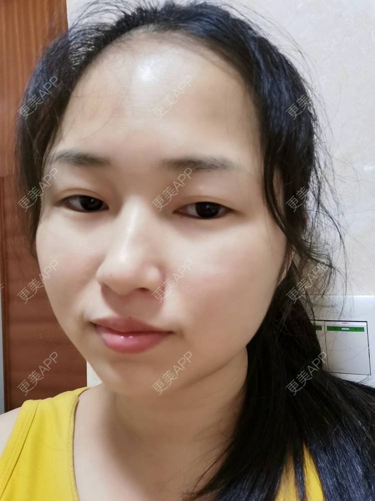 更美 - 小桃桃源的清洁水光补水经验 | 皮肤综合管理套餐 | 广州 | 清洁水光补水