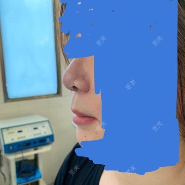 更美用户wfRXvUvAU0