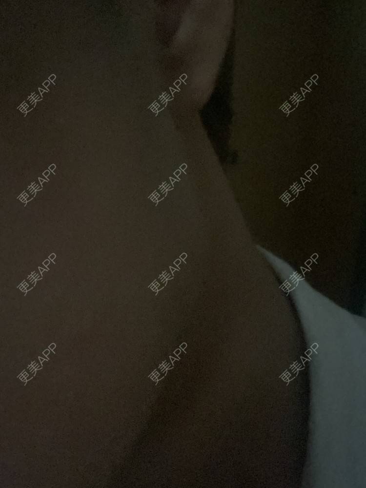 更美 - Phoebus的除皱瘦脸经验 | 除皱瘦脸 | 重庆