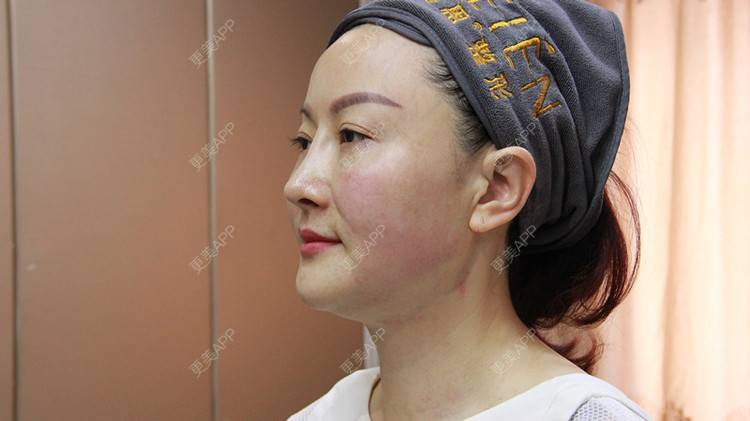 更美 - 欣欣向容1的热玛吉经验 | 视频日记 | 热玛吉 | 重庆