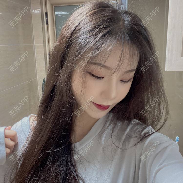 更美 - 天使爱美丽1的下颌角切除经验 | 广州 | 视频日记 | 下颌角切除